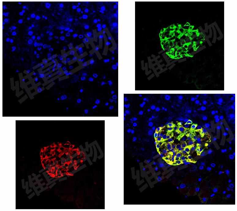 Immunofluorescence of mouse pancreas after AAV8-insulin-GFP injection: insulin shown in red and GFP in green