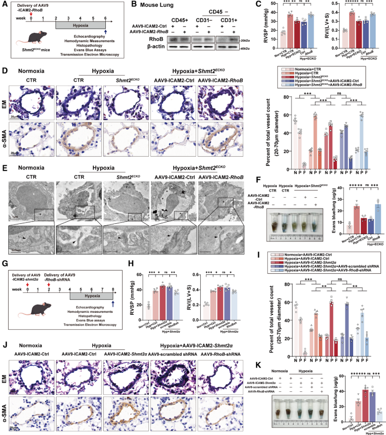 [AAV_Adenovirus_Plasmid Application Cases in the Lung] Mechanism of RhoB-mediated endothelial barrier injury