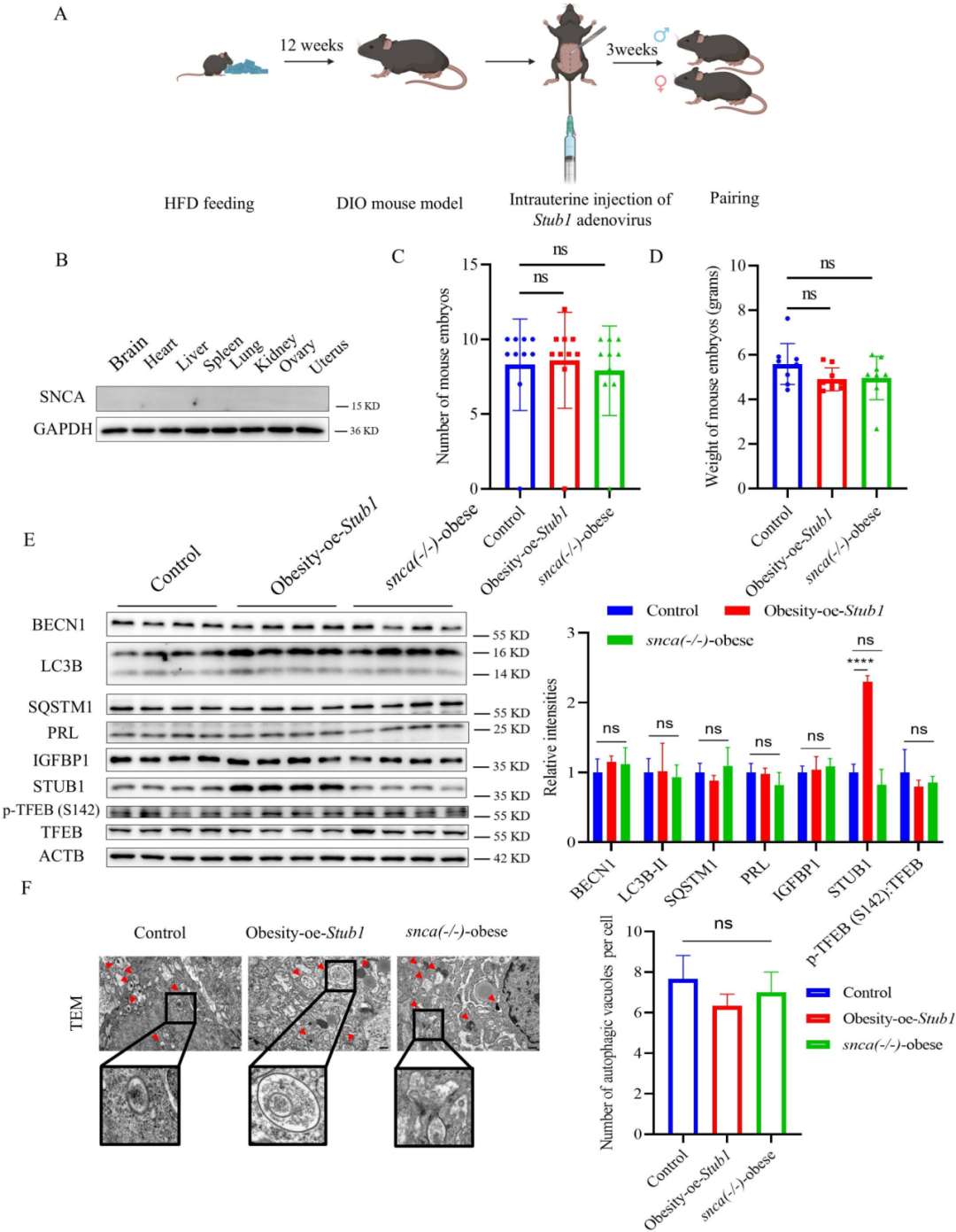 Figure 2 SNCA promotes obesity-related decline in endometrial receptivity by inhibiting STUB1-TFEB-mediated autophagy