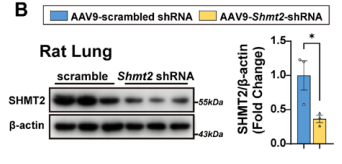 [AAV_Adenovirus_Plasmid Application Cases in the Lung] SHMT2 protein expression is significantly reduced in lung tissue of AAV9-Shmt2-shRNA-treated rats