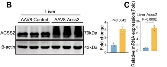 WB and qPCR experiments demonstrate successful Acss2 overexpression