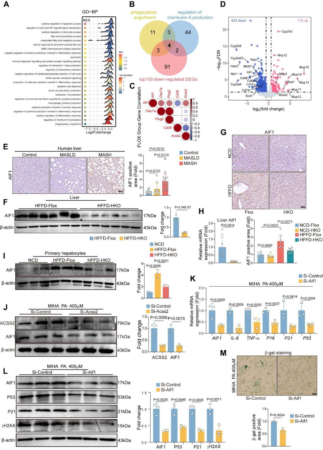 Figure 2 ACSS2 regulates hepatocyte senescence by modulating AIF1 expression