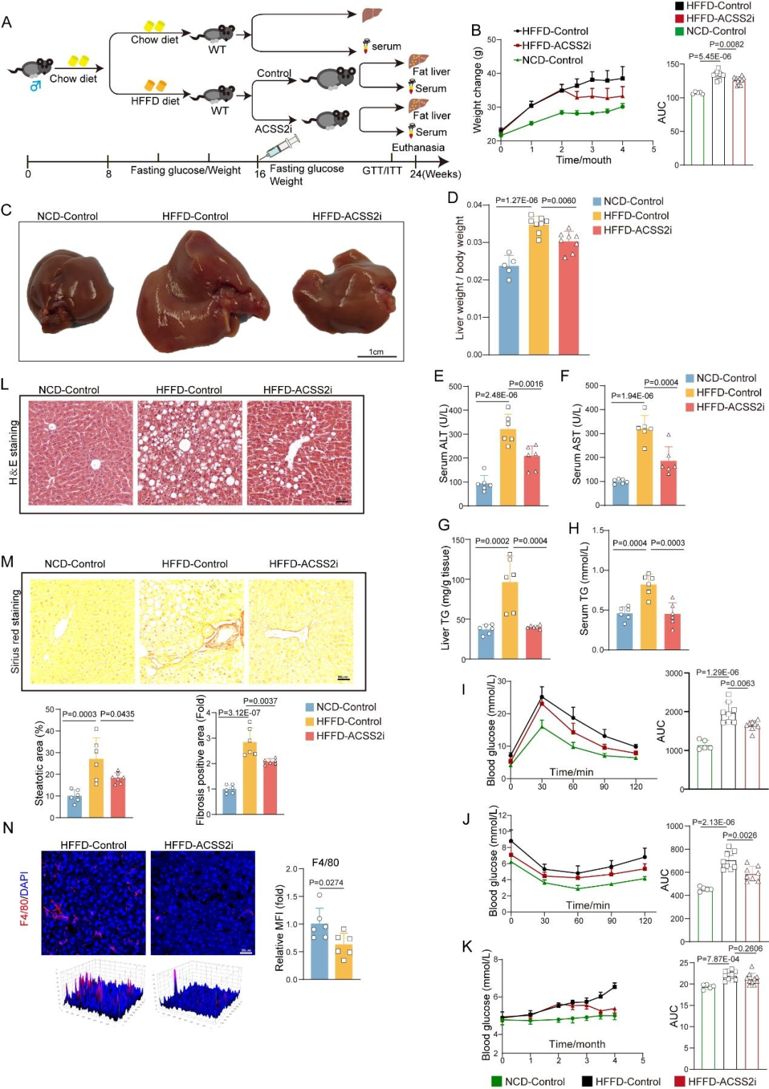 Figure 3 Pharmacological inhibition of ACSS2 significantly suppresses HFFD-induced MASH