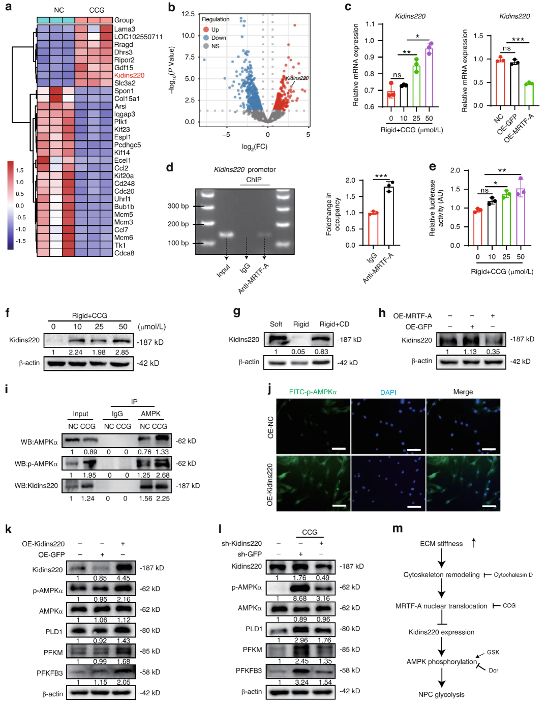 Figure 2 MRTF-A suppresses AMPK phosphorylation and reduces glycolysis by decreasing Kidins220 expression