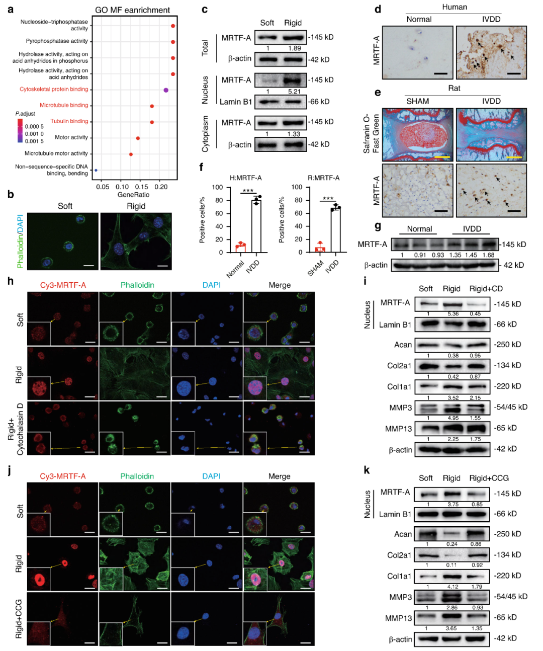 Figure 1 Matrix stiffness activates MRTF-A and promotes NPC degeneration