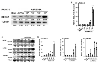 Western blot detection of Ad-REG3A overexpression efficiency in SW1990, PANC-1, AsPC-1 and BxPC-3 cells