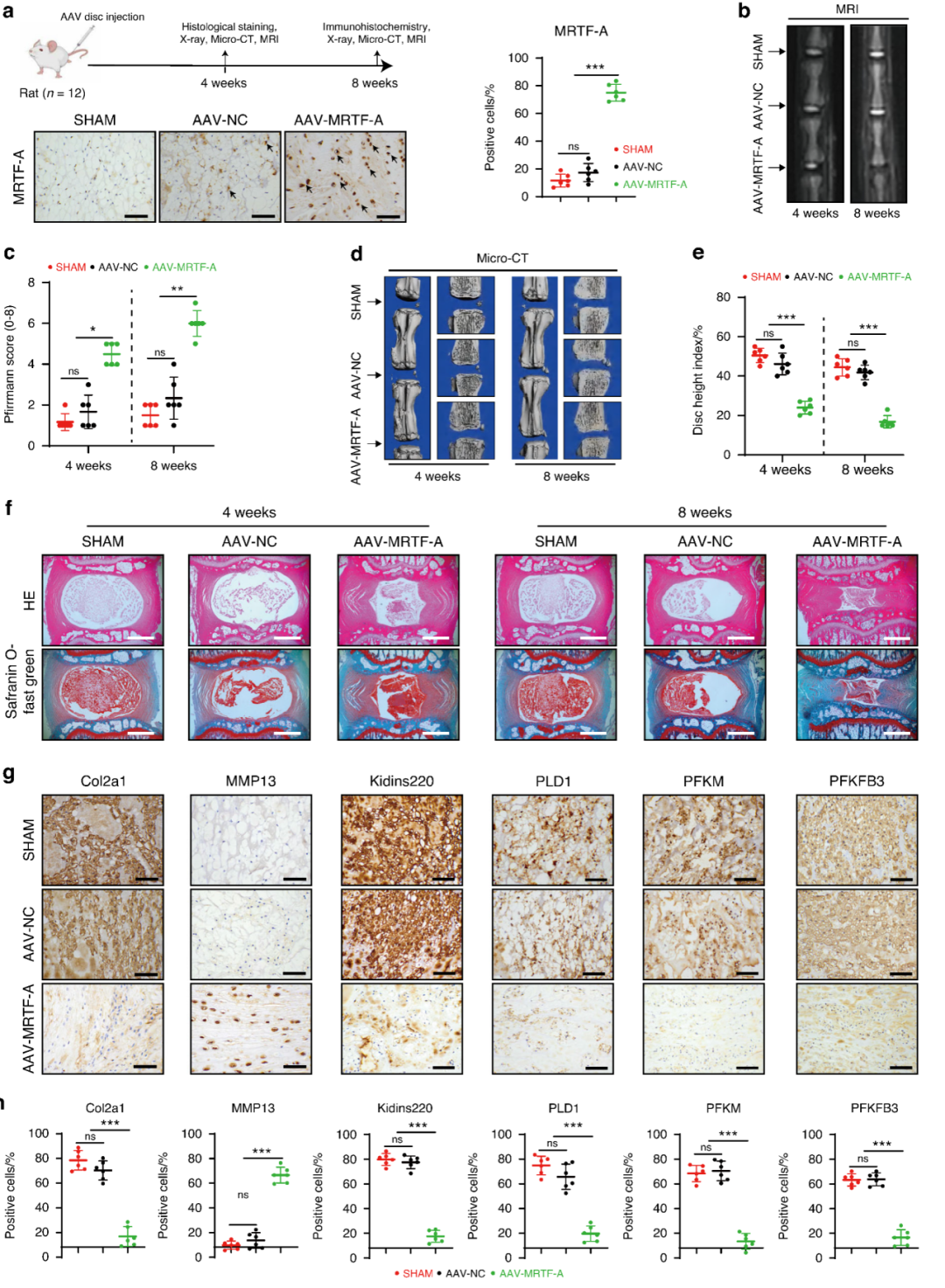 Figure 3 MRTF-A overexpression in NP tissue accelerates IVDD progression