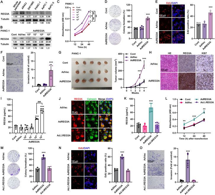REG3A promotes PDAC tumour growth in vitro and in vivo