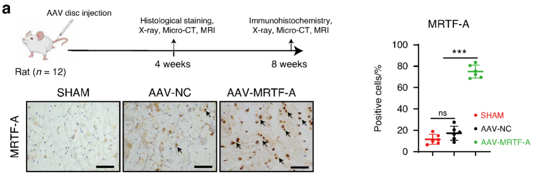 AAV successfully mediates MRTF-A expression in nucleus pulposus tissue