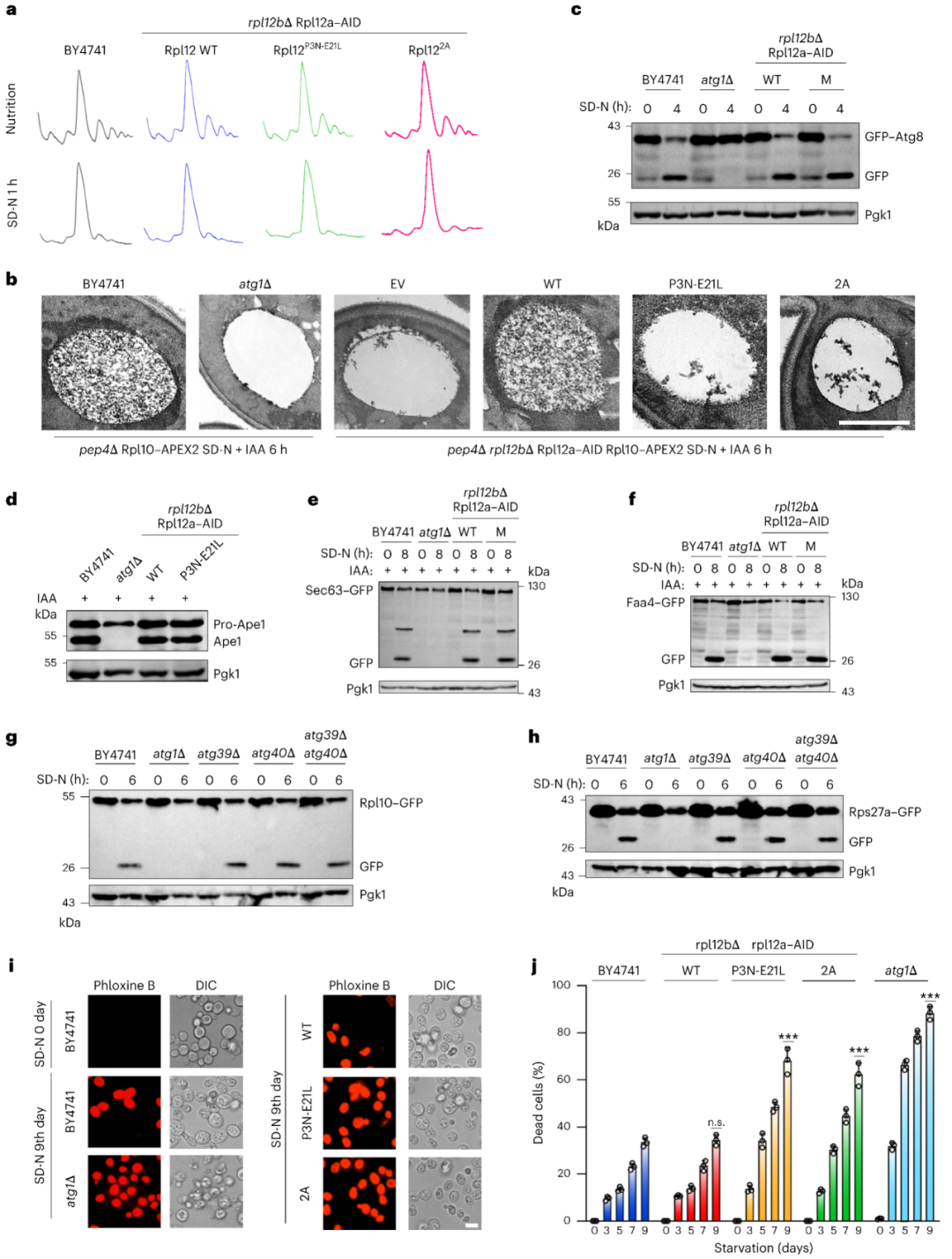 Figure 2 Ribophagy is essential for cell survival during starvation