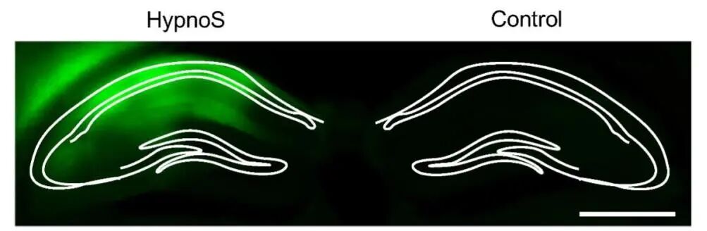 AAV2/9-hSyn-HypnoS mediates HypnoS expression in the hippocampus