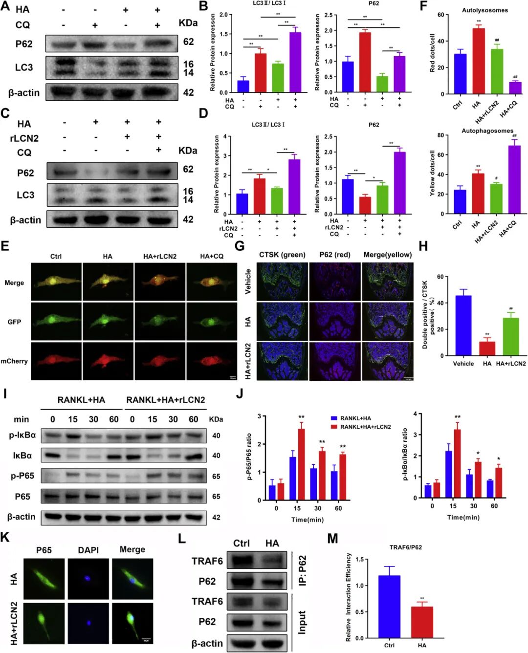 Figure 1. Effects of rLCN2 on autophagy, NF-κB signalling and the p62-TRAF6 interaction in BMMs