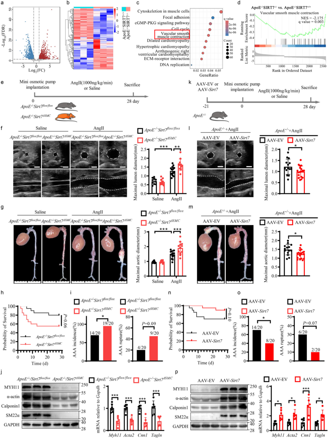 SIRT7 prevents AngII-induced AAA formation by regulating VSMC phenotype switching