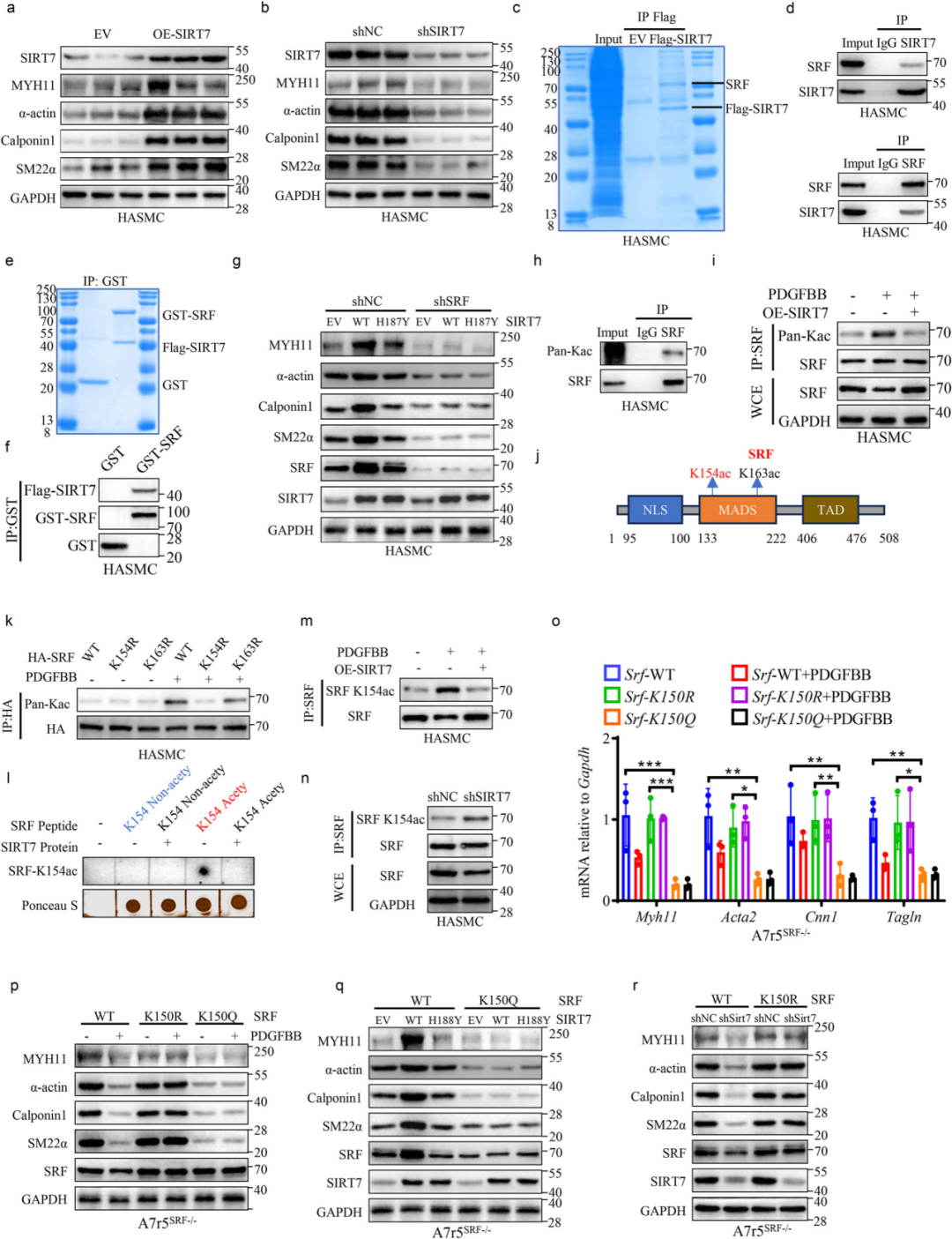 SIRT7 regulates VSMC phenotype switching in vitro by deacetylating SRF