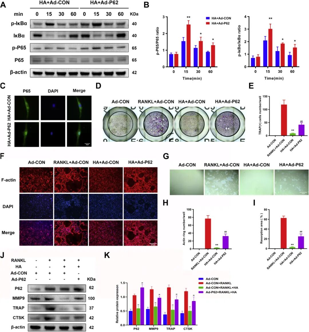 Figure 2. Effects of p62 overexpression on NF-κB signalling and osteoclastogenesis