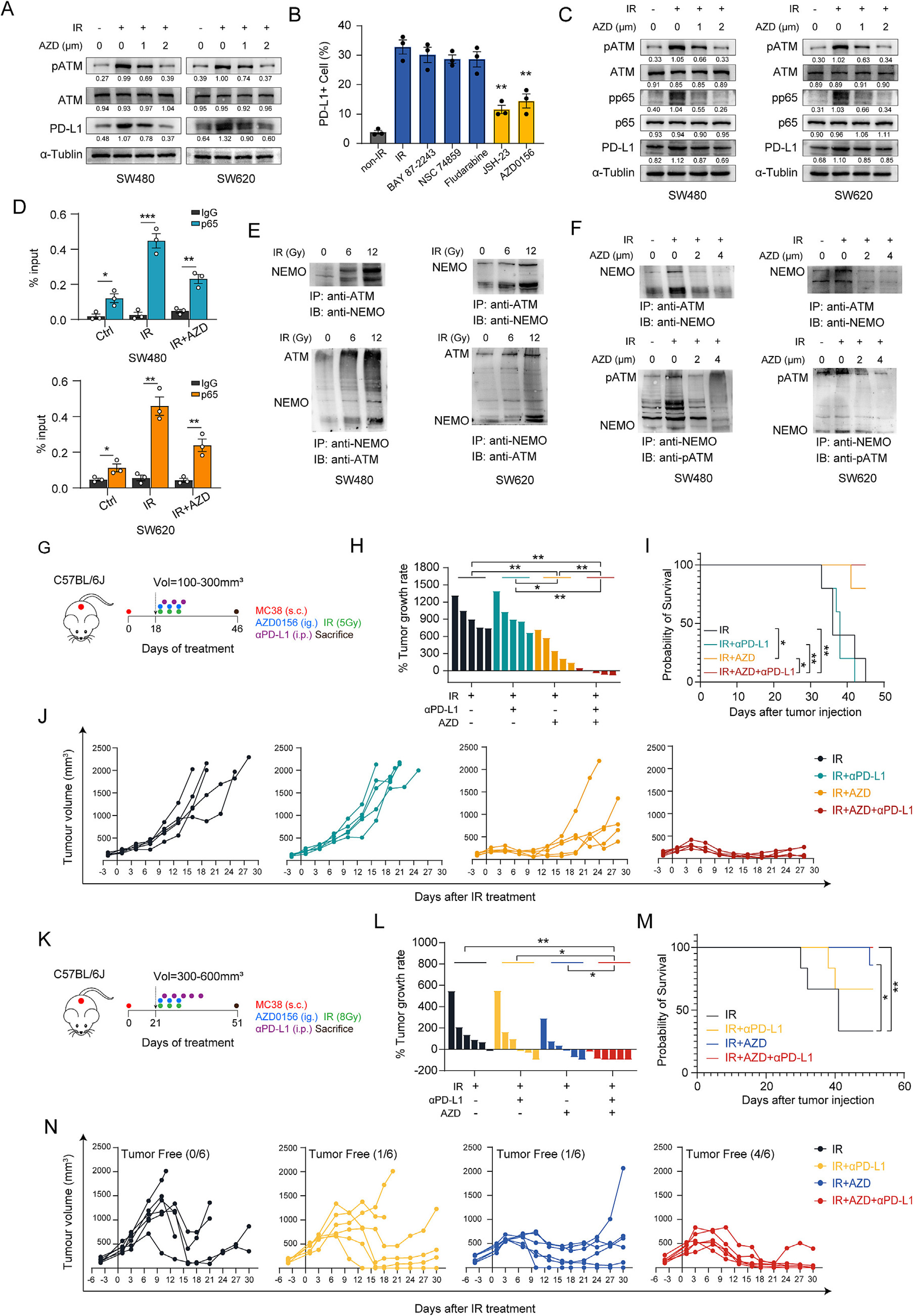 Figure 3. Triple therapy combining radiotherapy with AZD0156 and anti-PD-L1 blockade significantly enhances antitumour activity