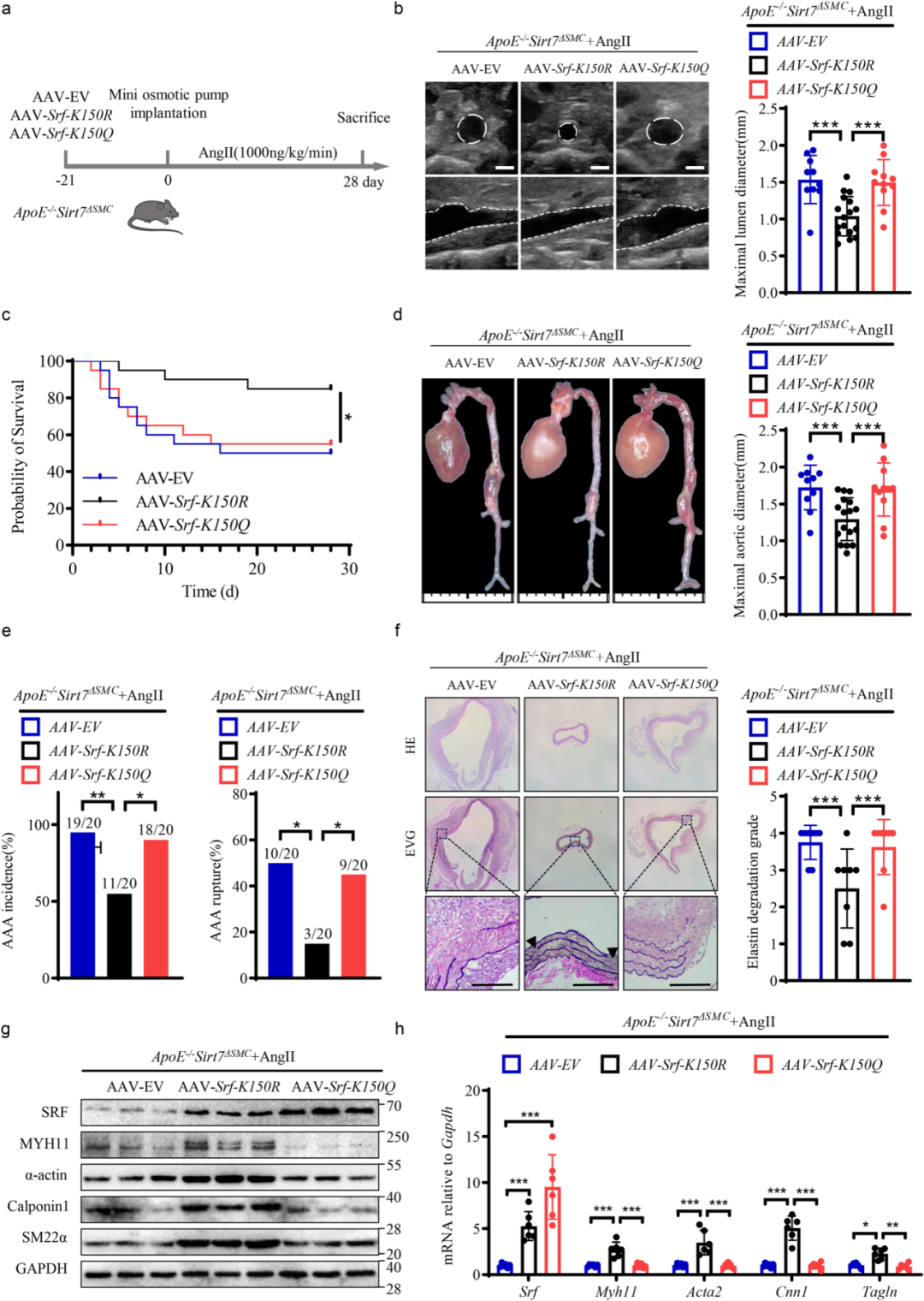 Overexpression of deacetylated SRF-K154 alleviates aortic aneurysm