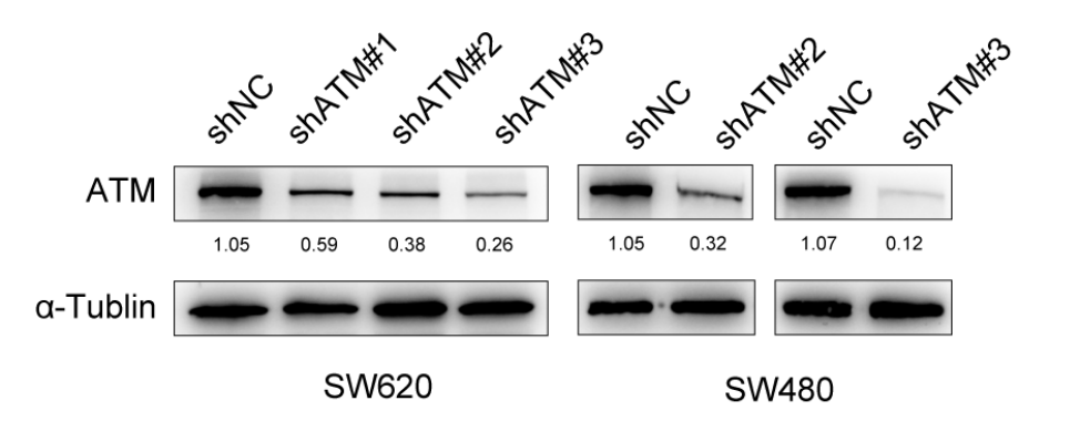 Lv-shATM knocks down ATM expression in SW620 and SW480 cells