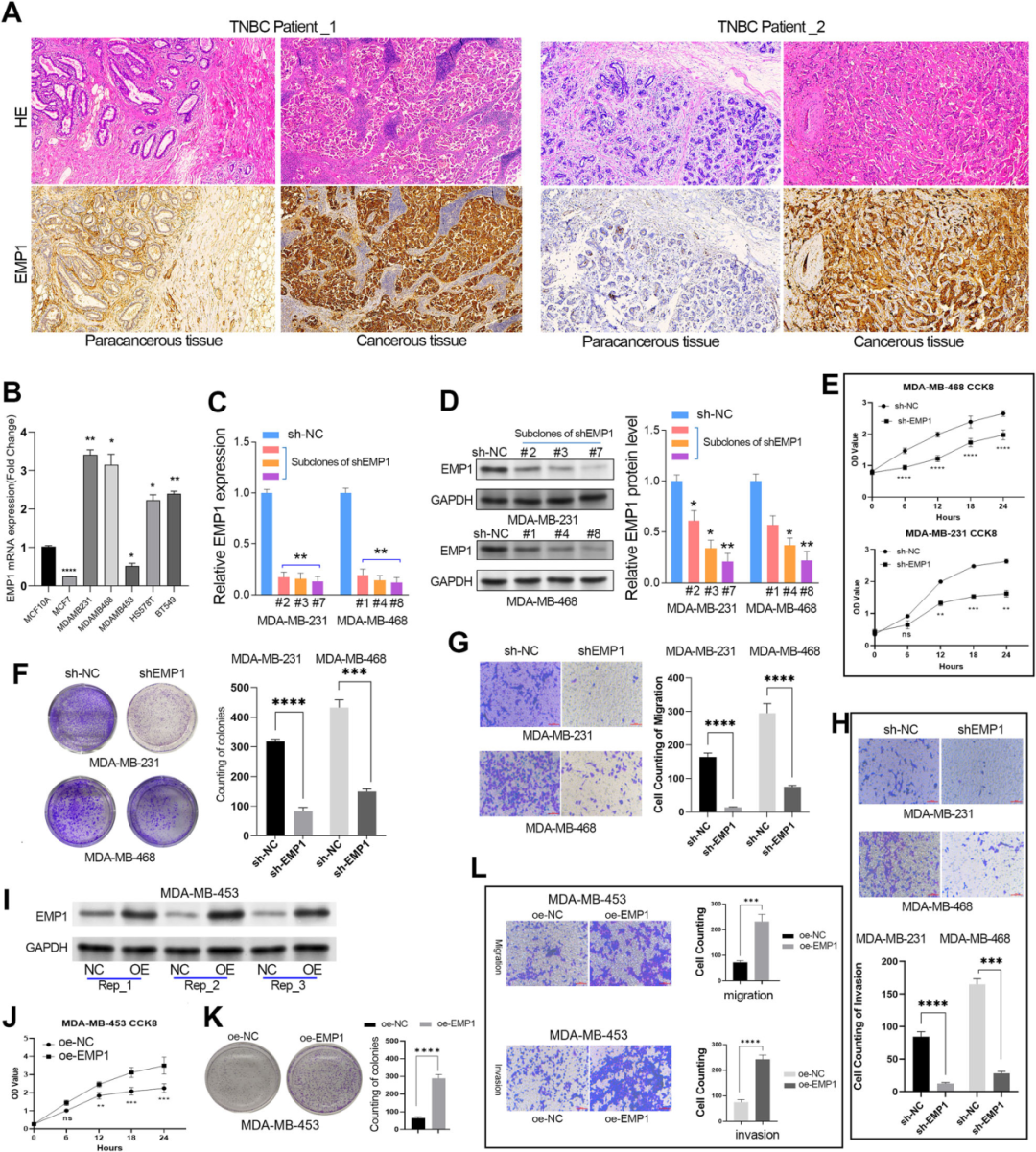 Figure 2. EMP1 exerts oncogenic properties in TNBC cell lines