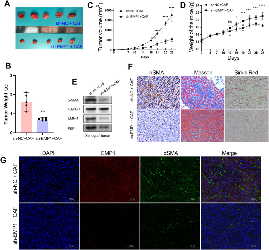 Figure 3. EMP1 is required for CAF infiltration in xenografts