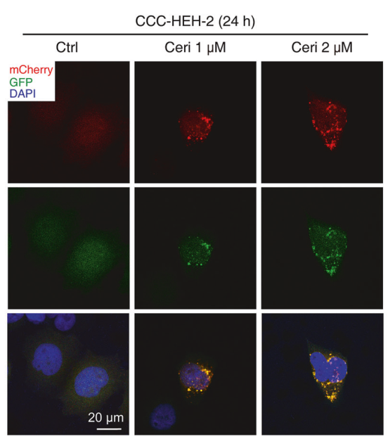 Confocal images of the Ad-mCherry-GFP-LC3 reporter system in CCC-HEH-2 cells