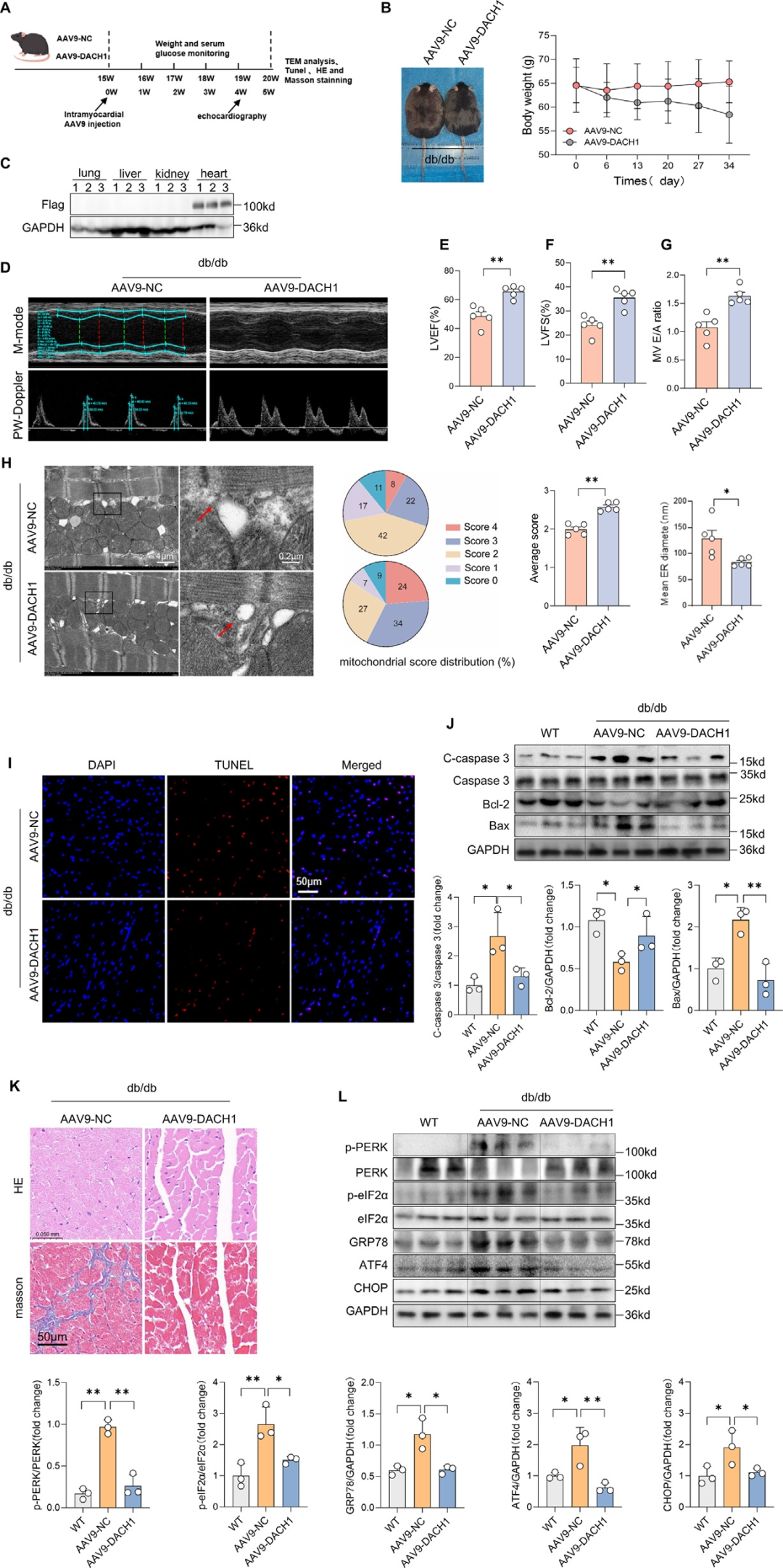Figure 1. Cardiac-specific overexpression of DACH1 rescues cardiac dysfunction and attenuates myocardial injury in diabetic mice