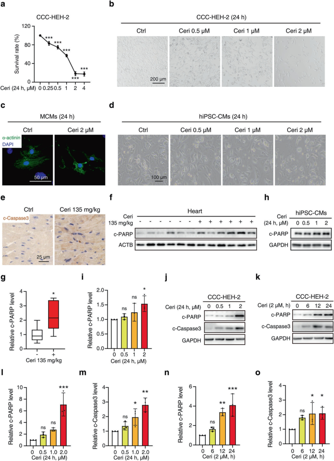 Figure 1. Ceritinib induces cardiomyocyte apoptosis in vivo and in vitro