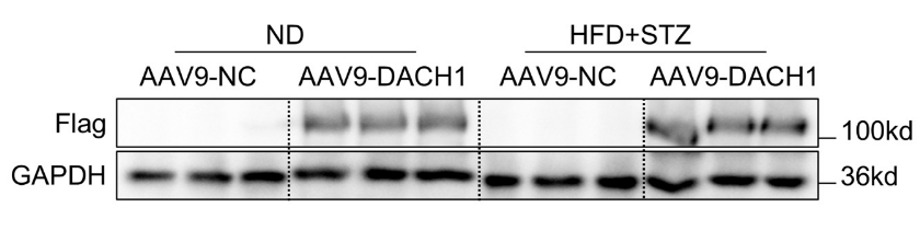 Successful overexpression of DACH1 in the heart