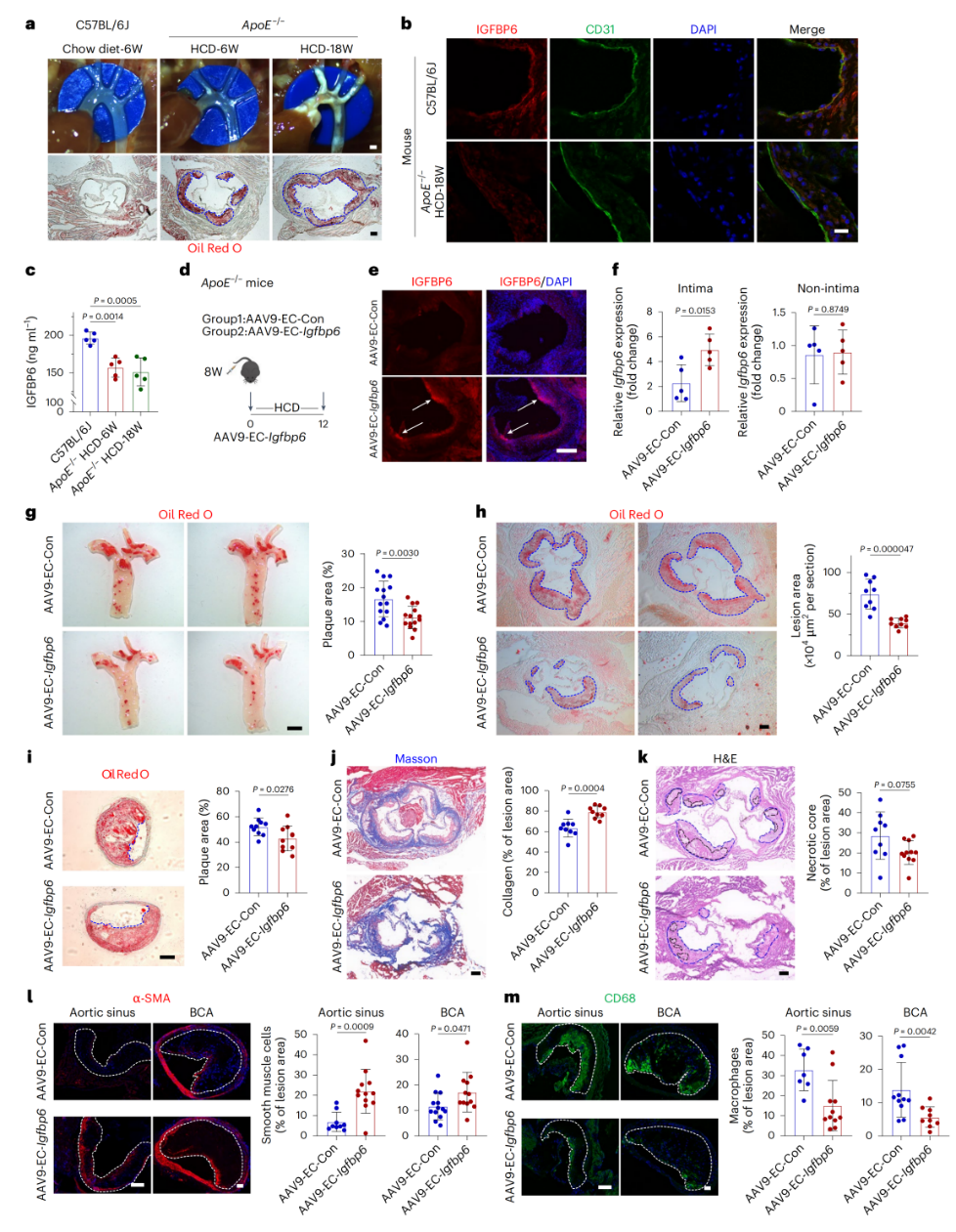 Figure 2. Endothelium-specific IGFBP6 overexpression ameliorates atherosclerosis in ApoE-/- mice