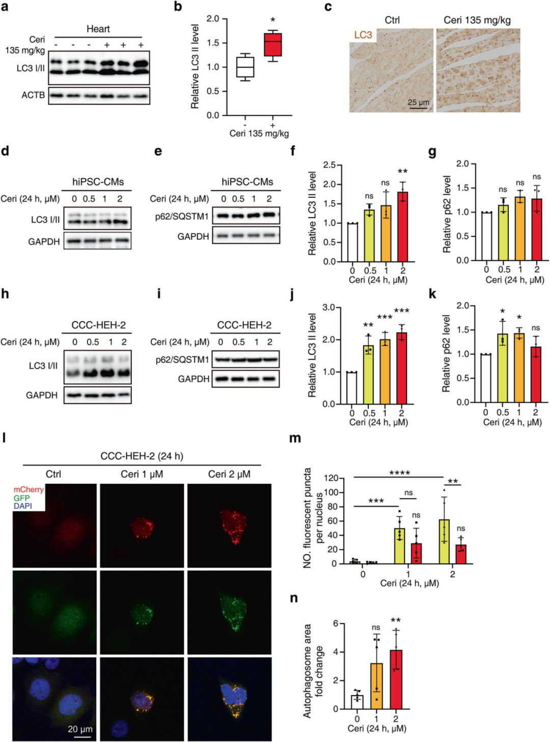 Figure 2. Ceritinib induces LC3-II accumulation and late-stage autophagy impairment in cardiomyocytes