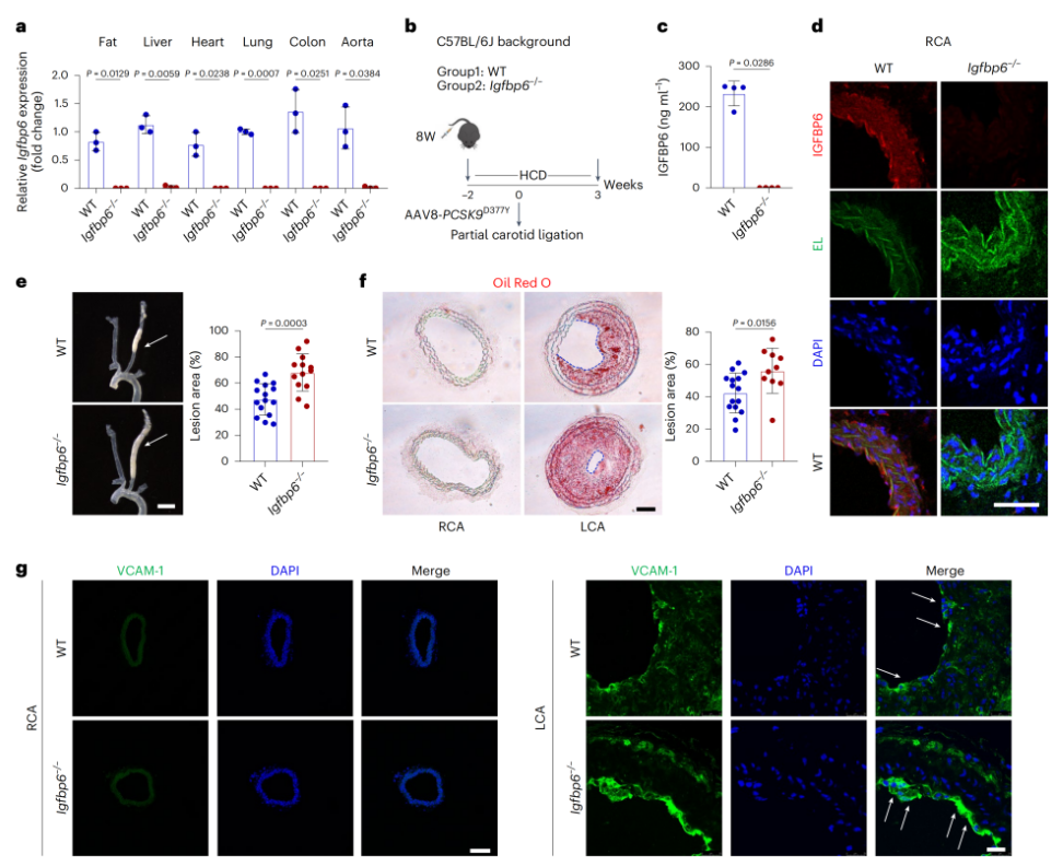 Figure 1. IGFBP6 deficiency increases atherosclerosis formation in mice subjected to PCL surgery