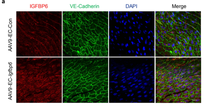 Immunofluorescence showing that AAV9-EC-Igfbp6 successfully mediates Igfbp6 overexpression in the mouse aorta