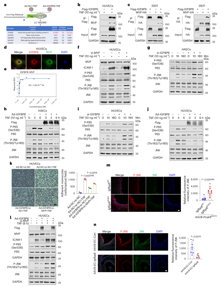 Figure 3. IGFBP6 suppresses endothelial inflammation via MVP-dependent inhibition of p65 and JNK phosphorylation
